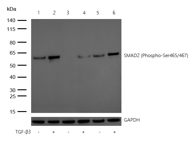 SMAD2 (Phospho-Ser465/467) Rabbit mAb