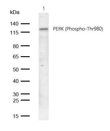 PERK (Phospho-Thr980) Rabbit mAb