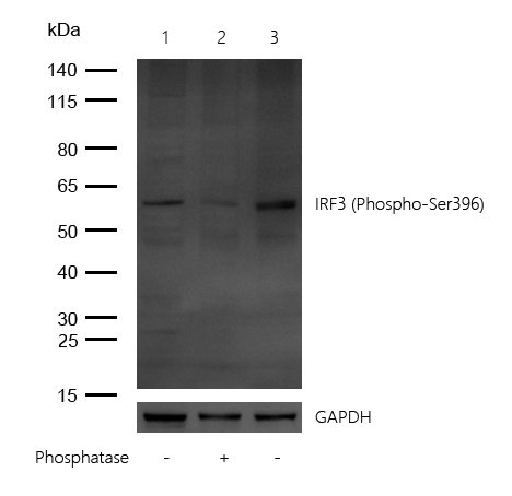 IRF3 (Phospho-Ser396) Rabbit mAb