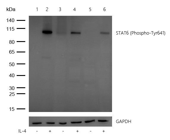 STAT6 (Phospho-Tyr641) Rabbit mAb