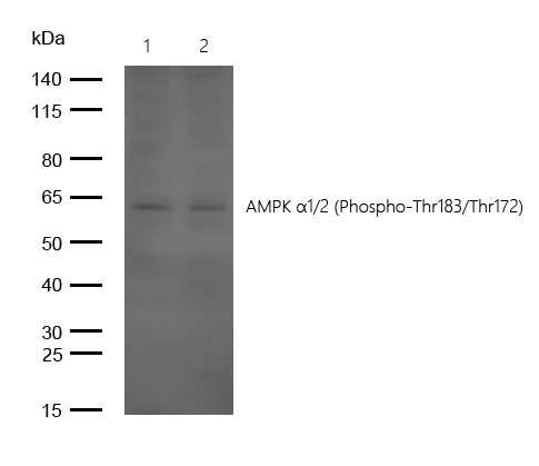 AMPK α1/2 (Phospho-Thr183/Thr172) Rabbit mAb