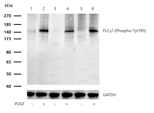 PLCγ1 (Phospho-Tyr783) Rabbit mAb