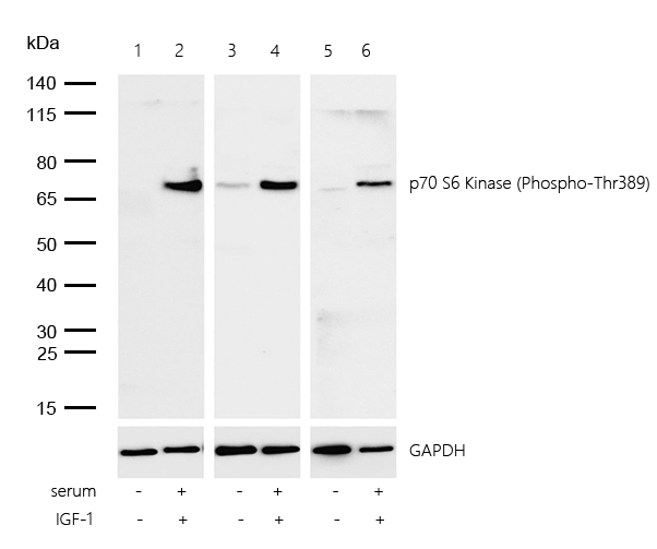 p70 S6 Kinase (Phospho-Thr389) Rabbit mAb