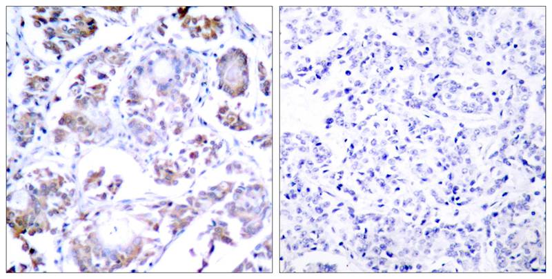 NFκB-p65 (Ab-254) Antibody