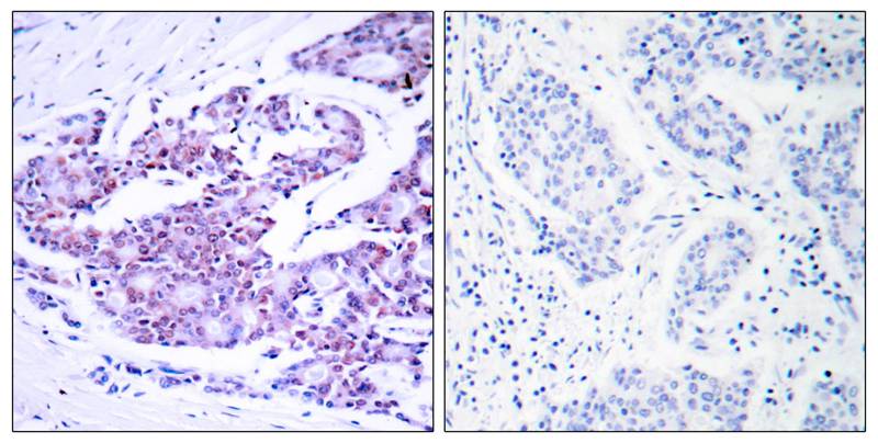 NFκB-p65 (Ab-468) Antibody