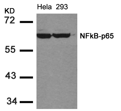 NFκB-p65 (Ab-536) Antibody