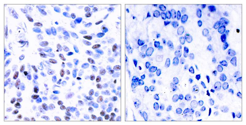 NFκB-p100/p52 (Ab-866) Antibody