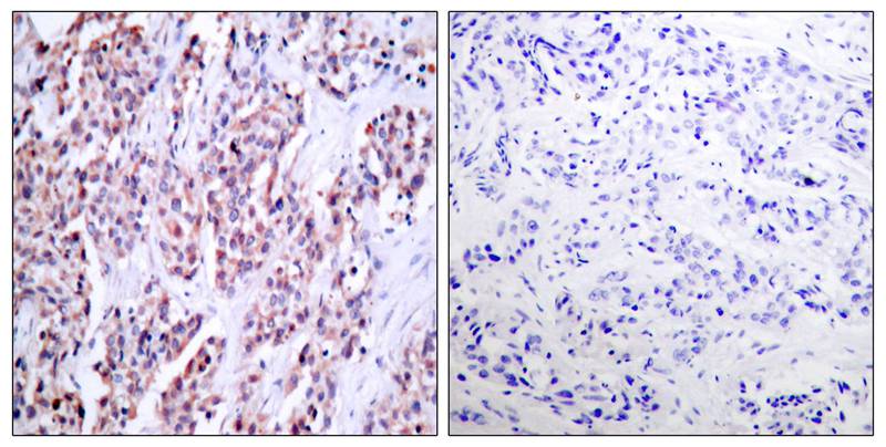 NFκB-p100/p52 (Ab-870) Antibody