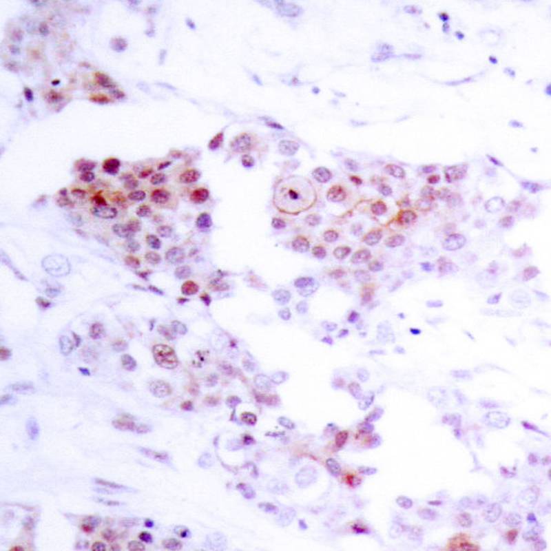 MEF2A (Ab-319) Antibody