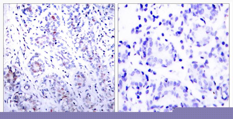 STAT3 (Ab-727) Antibody