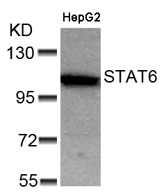 STAT6 (Ab-641) Antibody