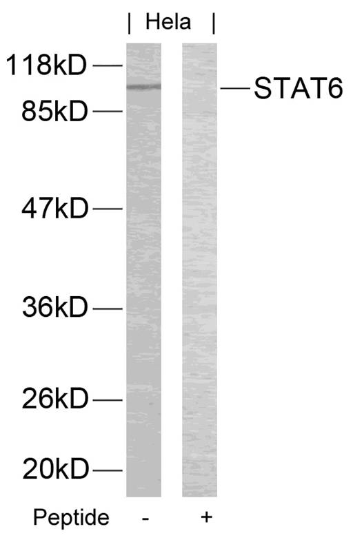 STAT6 (Ab-645) Antibody