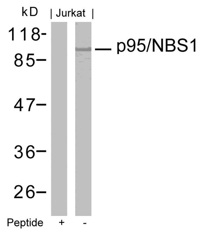 p95/NBS1 (Ab-343) Antibody