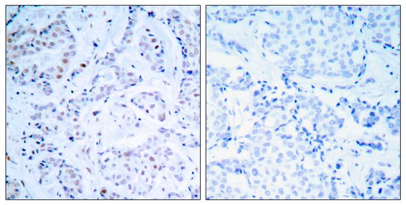 Estrogen Receptor-α (Ab04) Antibody