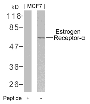 Estrogen Receptor-a Antibody