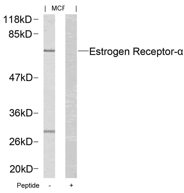 Estrogen Receptor-α (Ab67) Antibody