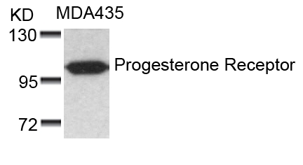 Progesterone Receptor (Ab90) Antibody