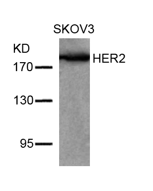 HER2 (Ab-877) Antibody