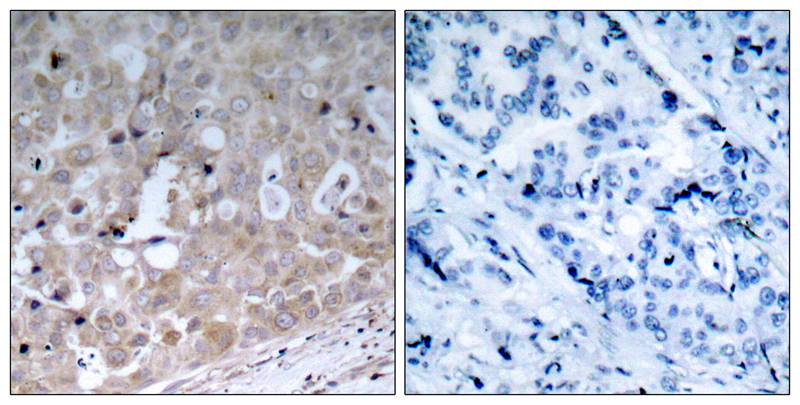 VEGFR2 (Ab175) Antibody