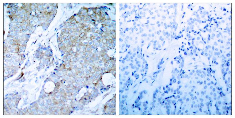 VEGFR2 (Ab214) Antibody