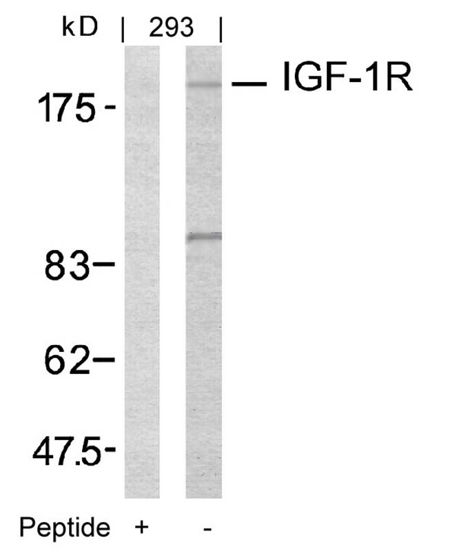 IGFR (Ab161) Antibody