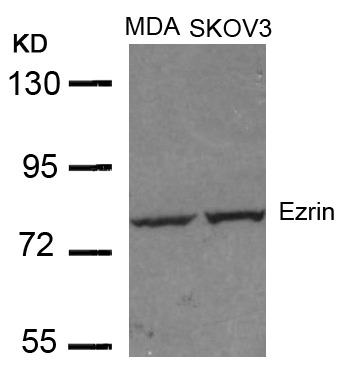 Ezrin (Ab-353) Antibody