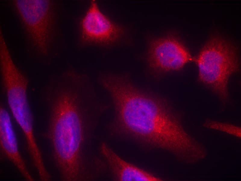 Tau (Ab-214) Antibody