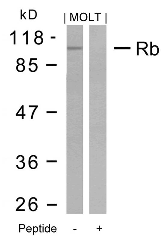Rb (Ab-795) Antibody