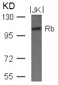 Rb (Ab-780) Antibody