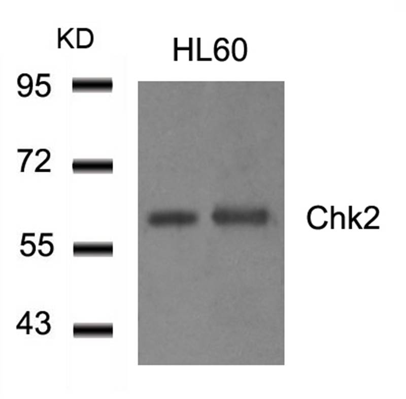 Chk2 (Ab-516) Antibody