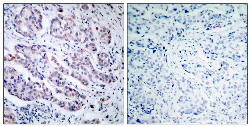 TYK2 (Ab054) Antibody
