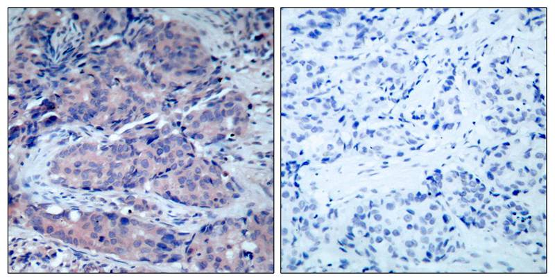 SEK1/MKK4 (Ab-261) Antibody