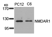 NMDAR1 (Ab-896) Antibody
