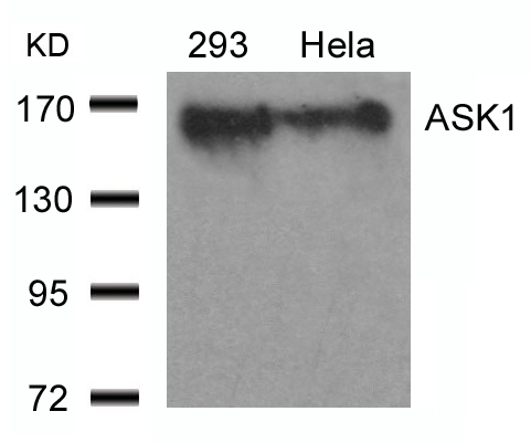 ASK1 (Ab-966) Antibody