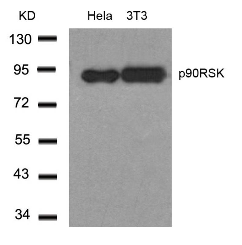 p90RSK (Ab-348) Antibody