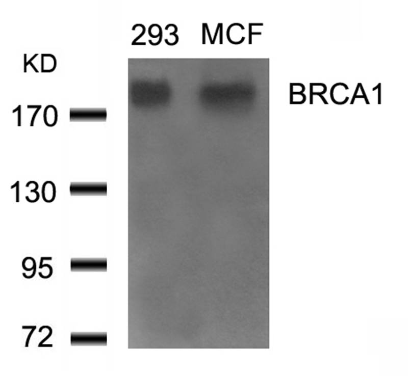 BRCA1 (Ab524) Antibody