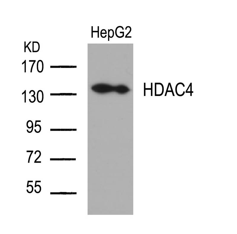 HDAC4 (Ab-632) Antibody
