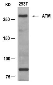 ATM (Ab981) Antibody
