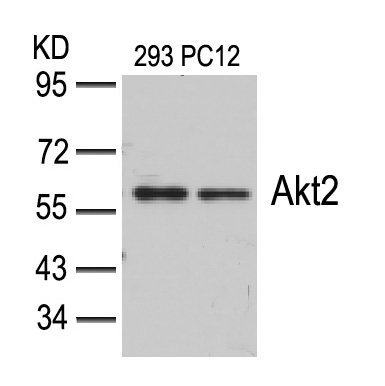 Akt2 (Ab-474) Antibody