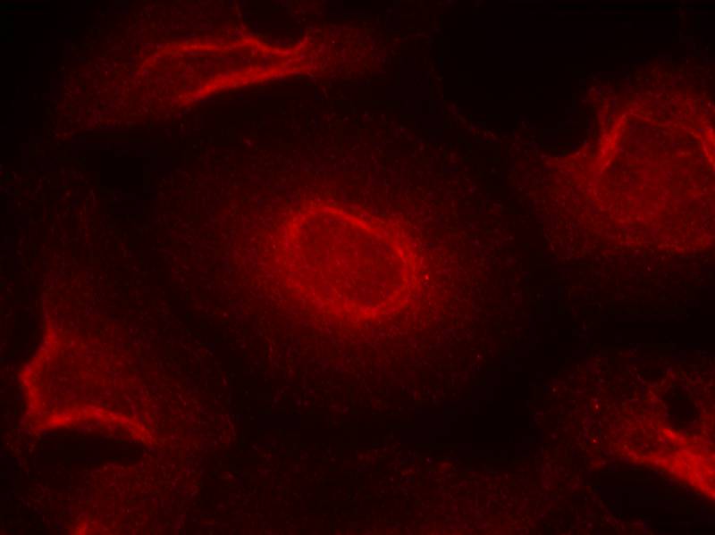 NMDAR2B (Ab474) Antibody