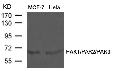 PAK1/PAK2/PAK3 (Ab-423/402/421) Antibody
