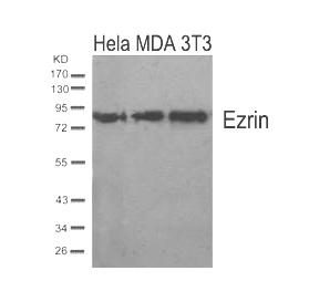 Ezrin (Ab-567) Antibody