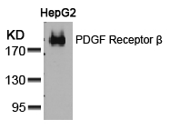 PDGF Receptor β (Ab-751) Antibody