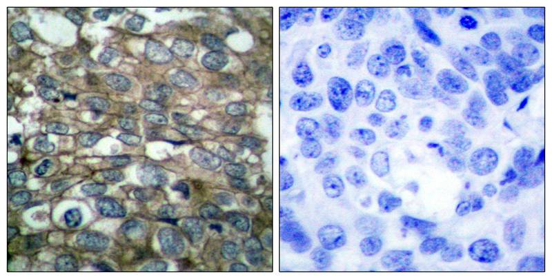 EGFR (Ab-869) Antibody