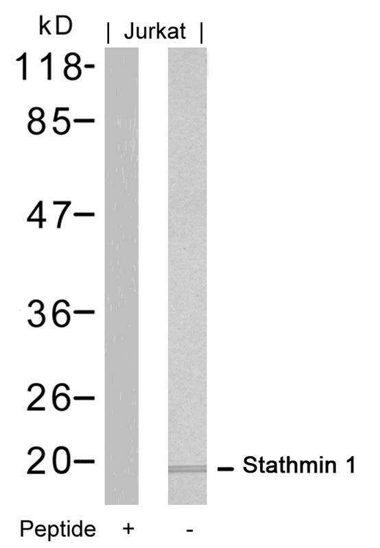 Stathmin 1 (Ab6) Antibody