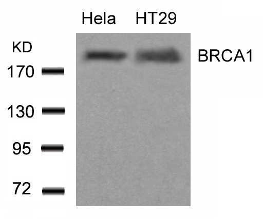 BRCA1 (Ab423) Antibody