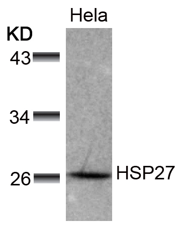 HSP27 (Ab-78) Antibody