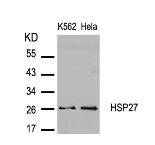 HSP27 (Ab-82) Antibody