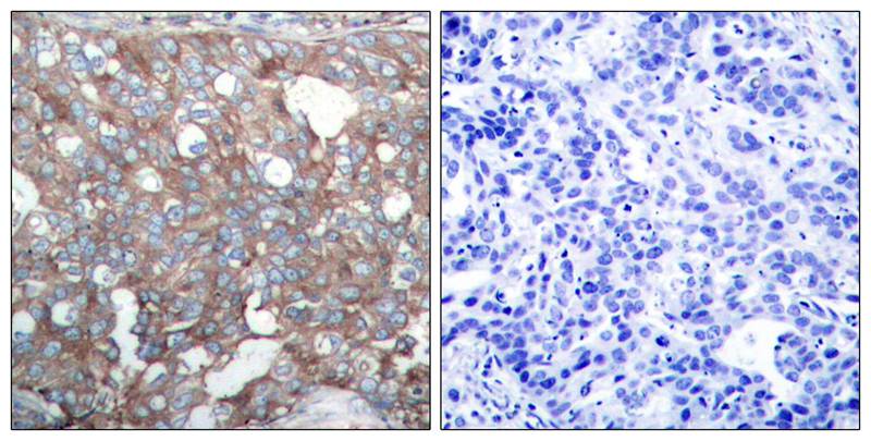 Cortactin (Ab-421) Antibody