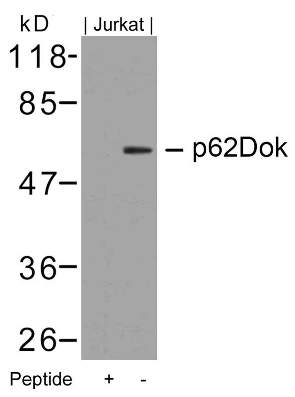 p62Dok (Ab-362) Antibody